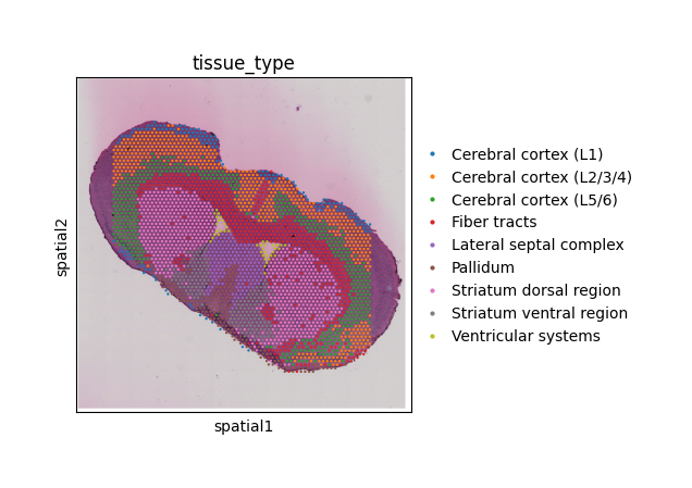 ../../_images/c8f705f1a956f358901115697203d6d09f58f6d5b22a74de7d63432b9ff7310b.png